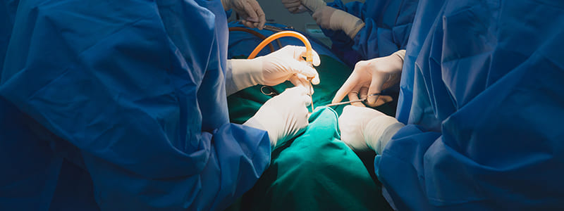 Verstandskies Laten Trekken Wat Zijn De Kosten MKA Groep